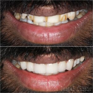 smilemake-over-18