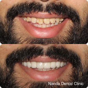 smilemake-over2