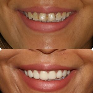 smilemake-over-2 (1)