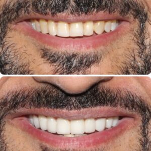 smilemake-over-2 (2)