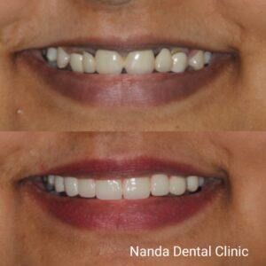 smilemake-over-2 (3)