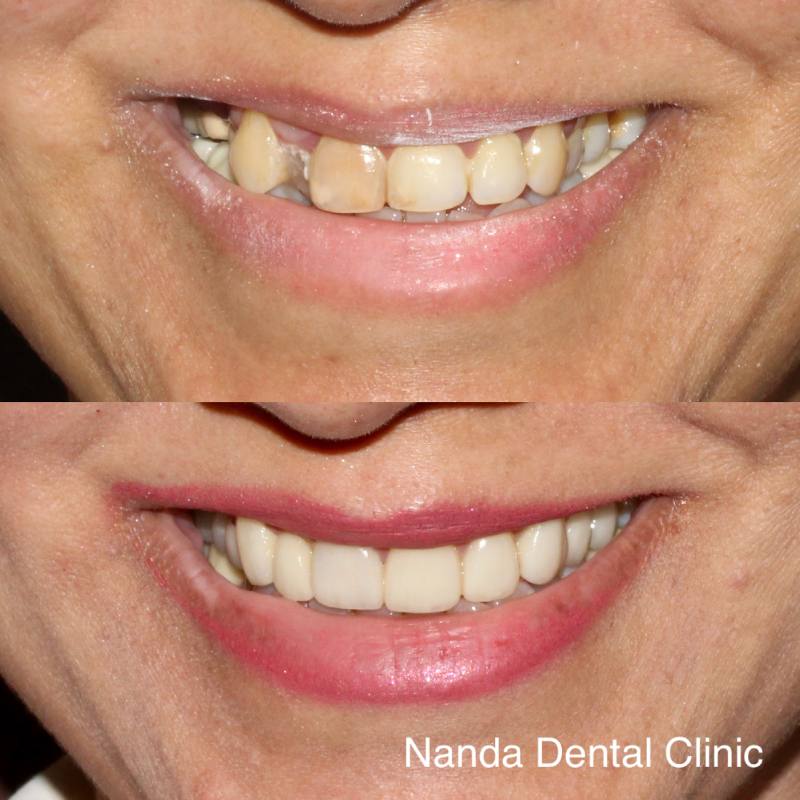 2EE2C204-0ABD-46FE-940A-F0CEA4BF5E4F