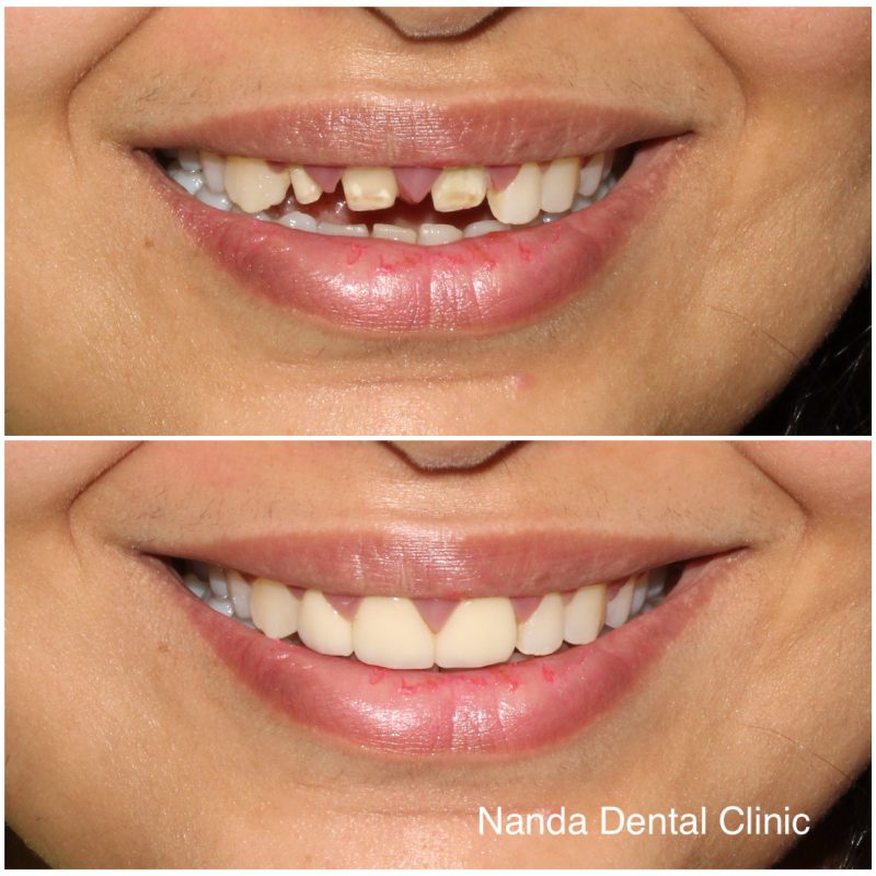 B94A83D5-5755-48EB-B7D5-C8EBA3D2AFAD