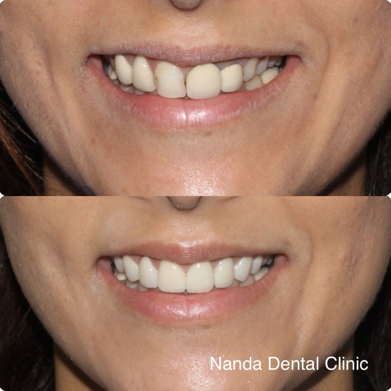 FB1B8E59-AACE-4178-AC96-2693D7804C10 (1)