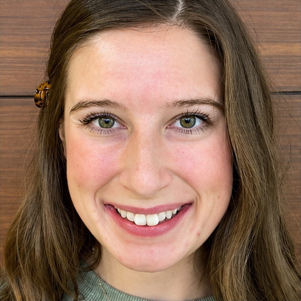 Before Invisalign – Invisalign