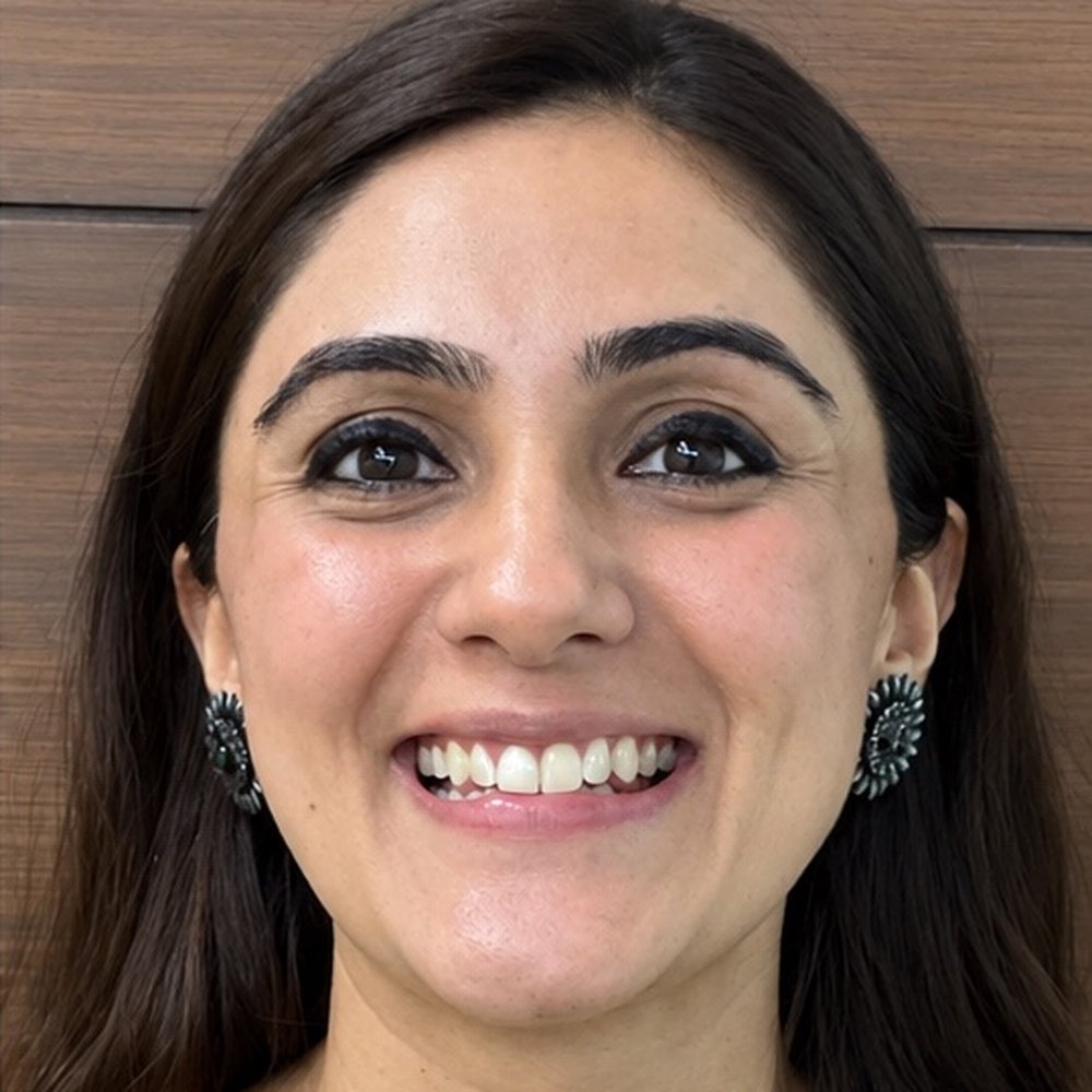 After Invisalign – Invisalign