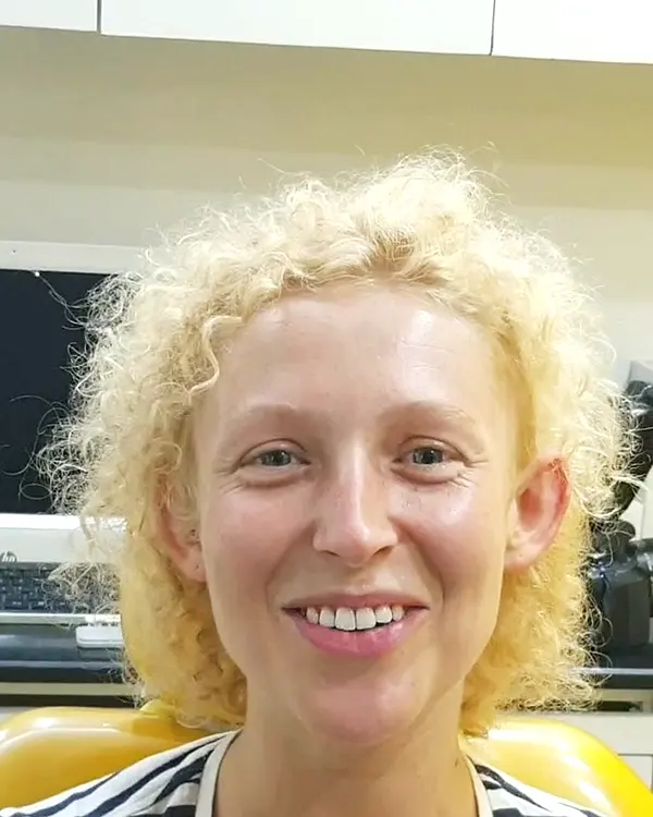 Hannah – patient testimonial, Nanda Dental