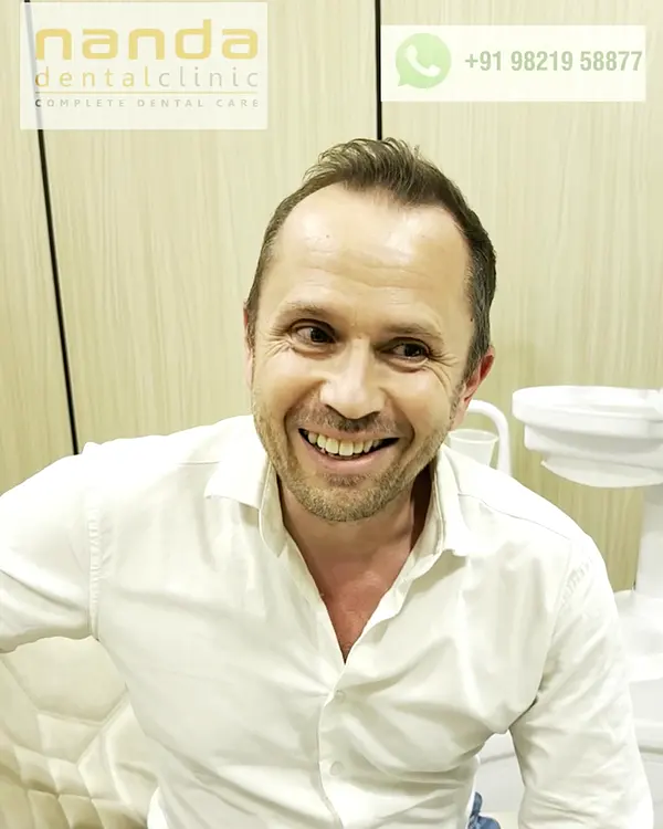 Alex Holmes – patient testimonial, Nanda Dental